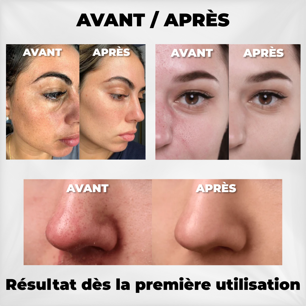 Dr. Melaxin - Exfoliant Peel Shot Coréen N°1