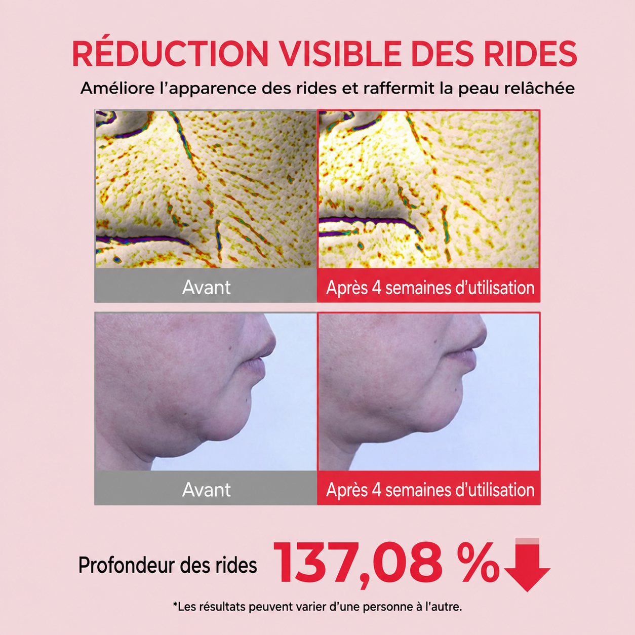 Crème Koriderm™ Time Reverse (Tout-En-Un) #1 en Corée