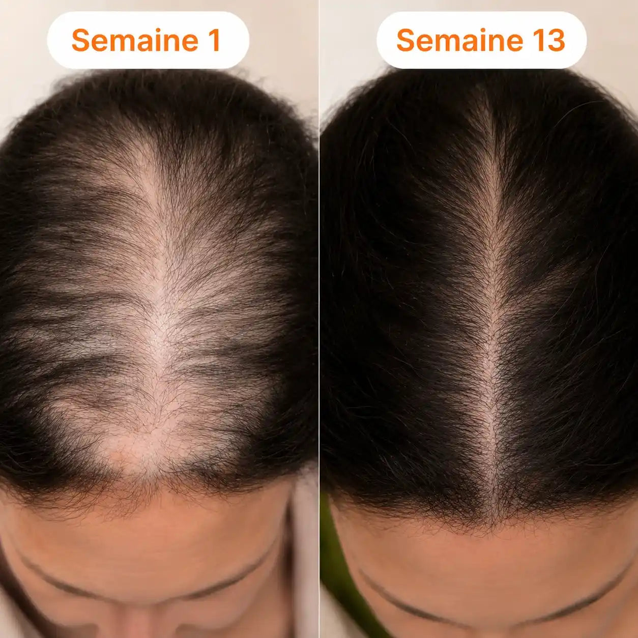 Sérum Capillaire Veliora Coréen N°1